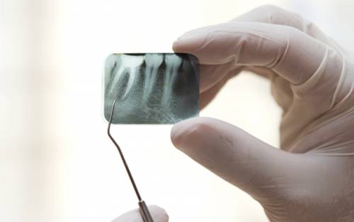 Рентген зуба Медикус